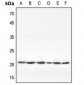 Anti-Claudin 1 Antibody