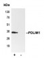 Anti-PDLIM1 Antibody