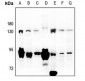 Anti-LZK Antibody