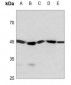 Anti-STK17B Antibody