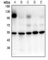 Anti-GPR52 Antibody