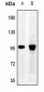 Anti-Synphilin 1 Antibody