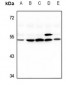 Anti-G3BP2 Antibody