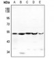 Anti-ENDOGL1 Antibody