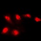 Anti-Histone Deacetylase 5 Antibody