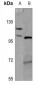 Anti-Histone Deacetylase 5 Antibody