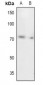 Anti-UBA2 Antibody