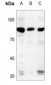 Anti-AASS Antibody