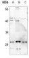 Anti-KCNMB2 Antibody