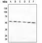 Anti-TXNRD2 Antibody