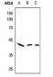 Anti-AHA1 Antibody