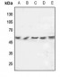 Anti-FGL2 Antibody