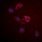 Anti-GPR75 Antibody