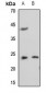 Anti-RAB35 Antibody