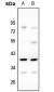 Anti-MRPL3 Antibody