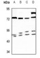 Anti-RASSF8 Antibody