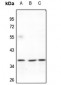 Anti-FAIM2 Antibody