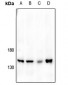 Anti-JIP3 Antibody