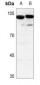 Anti-PIP5K1C Antibody