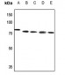 Anti-ABCB10 Antibody