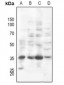 Anti-PI-TP beta Antibody