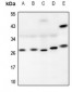 Anti-RAB26 Antibody