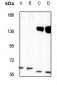Anti-TOR1AIP1 Antibody