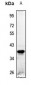 Anti-STEAP1 Antibody