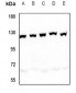 Anti-SND1 Antibody