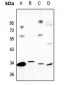 Anti-GPR82 Antibody