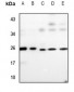 Anti-UBE2T Antibody