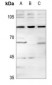 Anti-MGCRACGAP Antibody