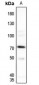 Anti-SENP1 Antibody