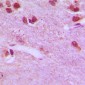 Anti-RPL26L1 Antibody