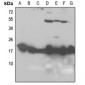 Anti-RPL26L1 Antibody