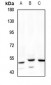 Anti-RHCG Antibody