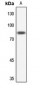 Anti-NUB1 Antibody