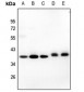 Anti-GIMAP4 Antibody