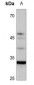 Anti-UBFD1 Antibody