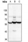 Anti-CHRNA10 Antibody