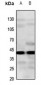 Anti-CYSLTR2 Antibody