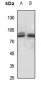 Anti-PAK7 Antibody