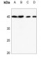 Anti-TRIB3 Antibody