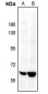 Anti-SENP2 Antibody