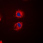 Anti-EPS8L2 Antibody