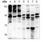 Anti-EPS8L2 Antibody