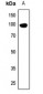 Anti-DDX54 Antibody