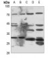 Anti-ELOVL6 Antibody