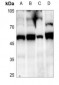 Anti-SUV39H2 Antibody