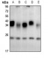 Anti-CSP Antibody